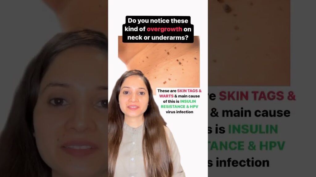 Natural Beauty & Home Remedies Videos for women